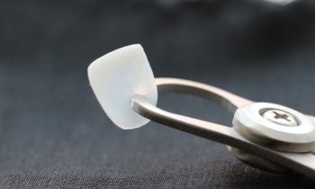 Lente de Contato dental
