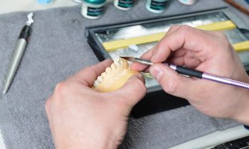 Implante Dentário