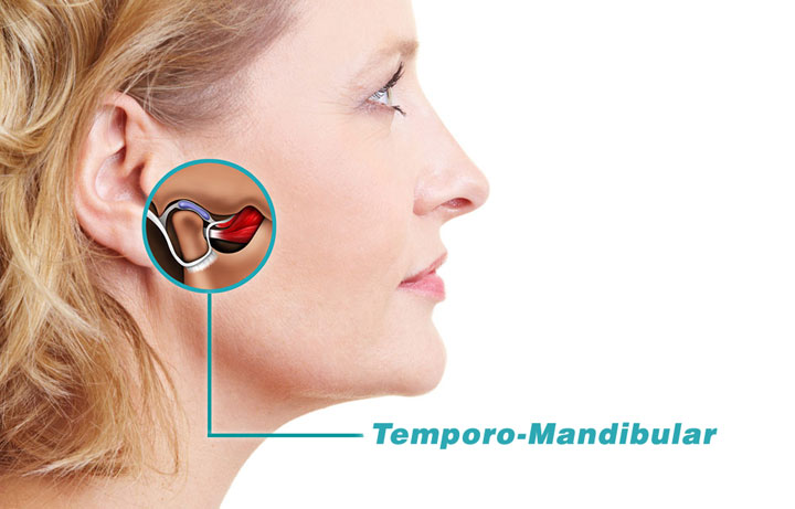 Sente dores ao movimentar a mandíbula?